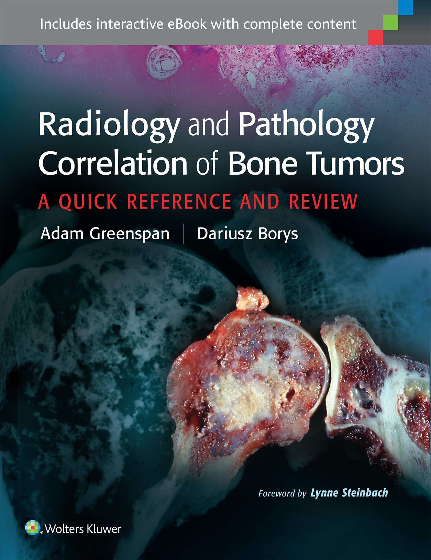 Radiology and Pathology Correlation of Bone Tumors (Hb 2016)