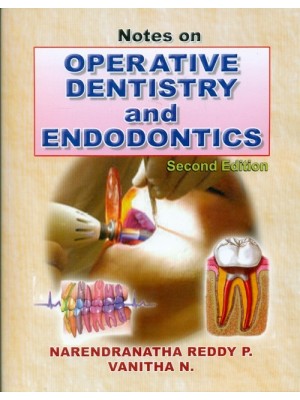 Notes on Operative Dentistry and Endodontics 2e