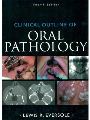 Clinial Outline of Oral Pathology 4e Pub. Price: $ 79.00 (PB)