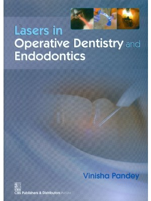 Lasers in Operative Dentistry and Endodontics (PB)