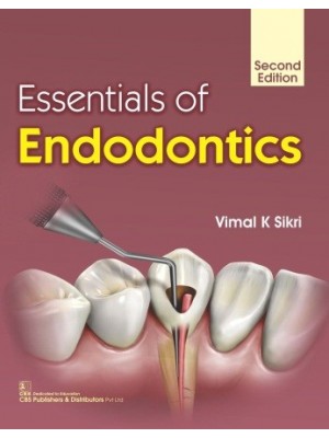 Essentials of Endodontics 2e (PB)