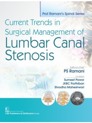 Current Trends In Surgical Management of Lumbar Canal Stenosis (PB)