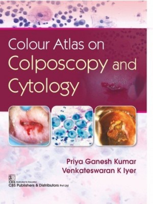 Colour Atlas on Colposcopy and Cytology (HB)