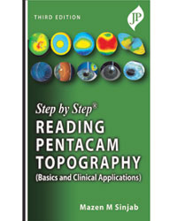 Step by Step Reading Pentacam Topography(Basics and Clinical Applications)|3/e