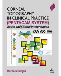Corneal Tomography in Clinical Practice (Pentacam System): Basics and Clinical Interpretation|4/e