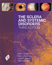 The Sclera and Systemic Disorders|3/e