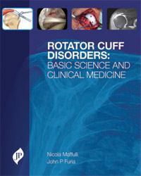 Rotator Cuff Disorders: Basic Science and Clinical Medicine|1/e