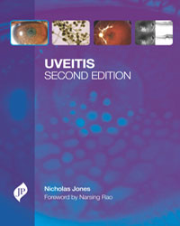 Uveitis with CD-ROM|2/e