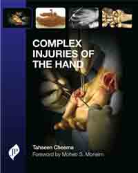 Complex Injuries of the Hand|1/e