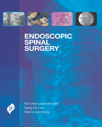 Endoscopic Spinal Surgery|1/e