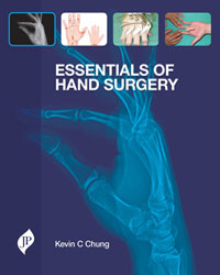 Essentials of Hand Surgery|1/e