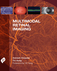Multimodal Retinal Imaging|1/e