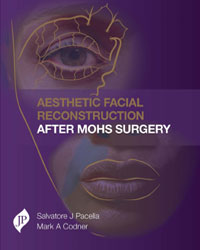 Aesthetic Facial Reconstruction After Mohs Surgery|1/e