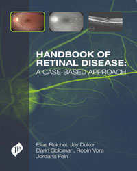 Handbook of Retinal Disease: A Case-Based Approach|1/e