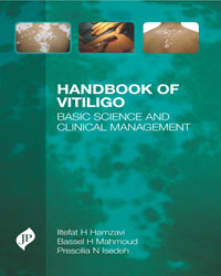 Handbook of Vitiligo|1/e