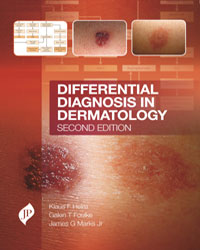 Differential Diagnosis in Dermatology|2/e