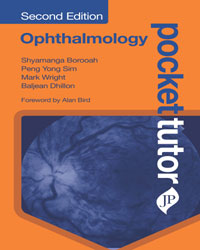 Pocket Tutor Ophthalmology|2/e