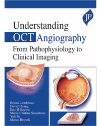 Understanding OCT Angiography From Pathophysiology to Clinical Imaging|1/e