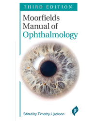 Moorfields Manual of Ophthalmology|3/e