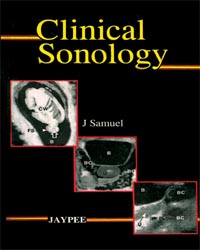Clinical Sonology|1/e