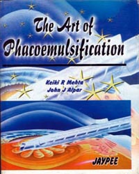 The Art of Phacoemulsification|1/e