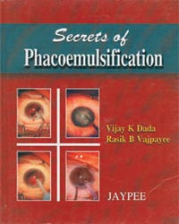 Secrets of Phacoemulsification|1/e