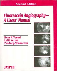 Fluorescein Angiography|2/e