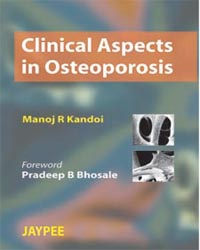 Clinical Aspects in Osteoporosis|1/e