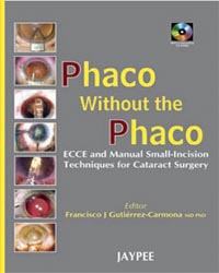 Phaco without Phaco with 2 CD-ROMs|1/e