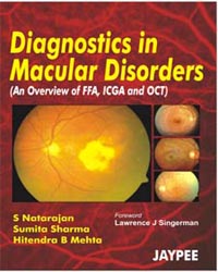 Diagnostics in Macular Disorders|1/e
