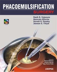 Phacoemulsification Surgery: A Practical Manual (with CD-ROM)Â |1/e