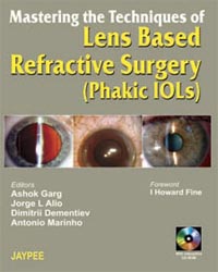 Mastering the Techniques of Lens Based Refractive Surgery|1/e