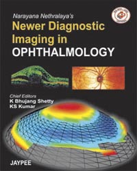 Narayana Nethralaya's Newer Diagnostic Imaging in Ophthalmology|1/e