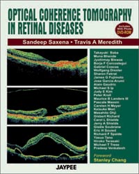 Optical Coherence Tomography in Retinal Diseases: with Photo DVD-ROM (Complete Book Available in PDF Format)Â |1/e