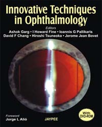 Innovative Techniques in Ophthalmology with DVD-ROM|1/e