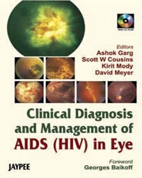 Clinical Diagnosis and Management of AIDS (HIV) in Eye with CD-ROM|1/e