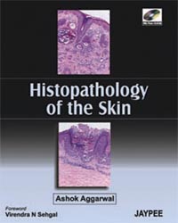 Histopathology of the Skin (with CD-ROM)|1/e