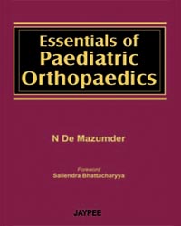 Essentials of Paediatric Orthopaedics|1/e