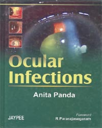 Ocular Infections|1/e