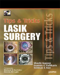 Tips & Tricks in Lasik Surgery (with DVD-ROM)|1/e