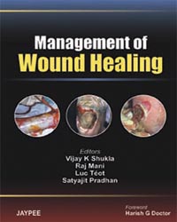 Management of Wound Healing|1/e
