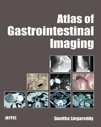 Atlas of Gastrointestinal Imaging|1/e