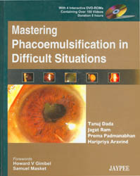 Mastering Phacoemulsification in Difficult Situations with 4 DVD-ROMs|1/e