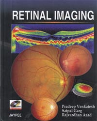 Retinal Imaging (with Photo DVD-ROM)|1/e