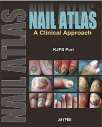 Nail Atlas: A Clinical Approach|1/e