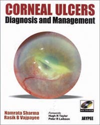Corneal Ulcers Diagnosis and Management with DVD-ROM|1/e