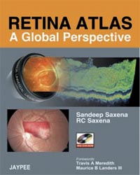 Retina Atlas-A Global Perspective (with DVD-ROM)|1/e