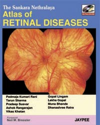 The Sankara Nethralaya Atlas of Retinal Diseases (with Photo DVD-ROM)Â |1/e