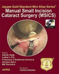 Jaypee Gold Standard Mini Atlas Series Manual Small incision Cataract Surgery (MSICS) with DVD-ROM|1/e
