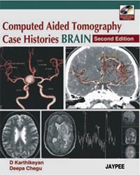 Computed Aided Tomography Case Histories BRAIN (with CD-ROM)|2/e